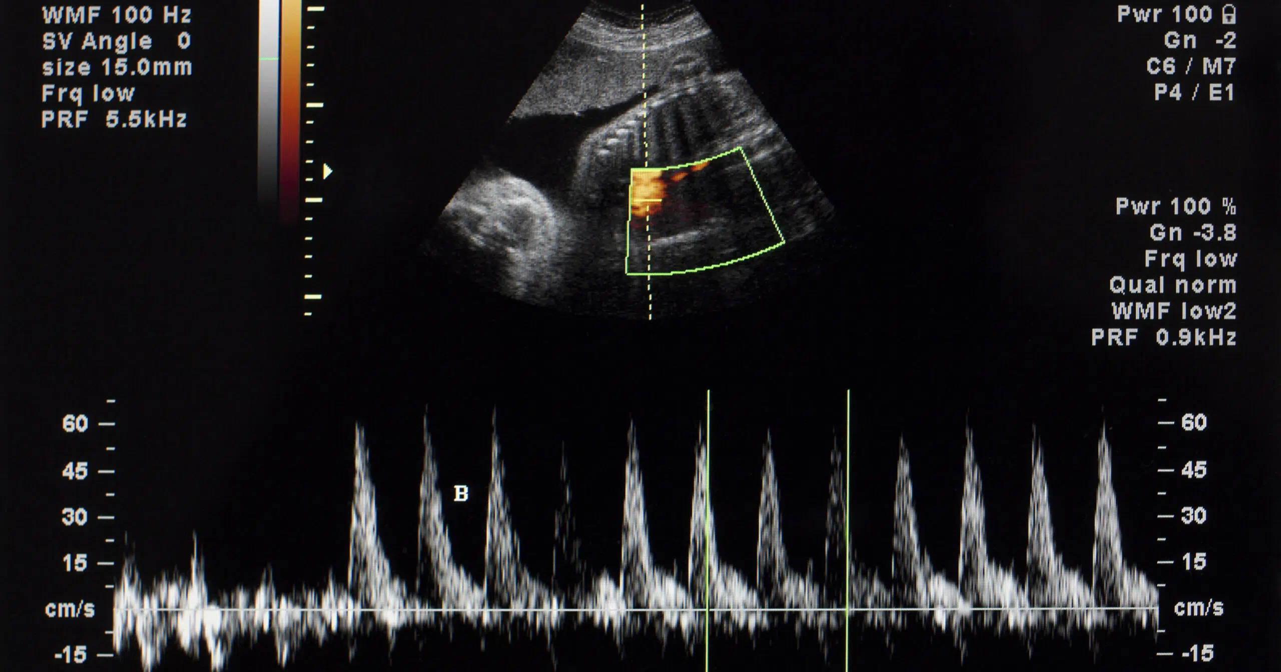 Fetal Echocardiographer